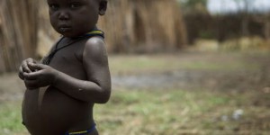 Projet de lutte contre la malnutrition dans le Nord (PLCM)